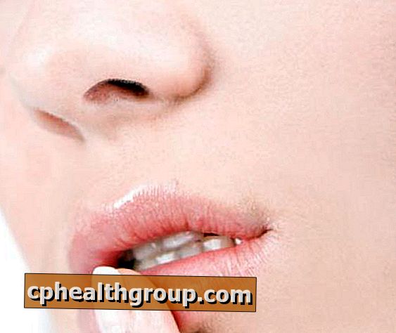 Как да облекчим отрязаните устни
