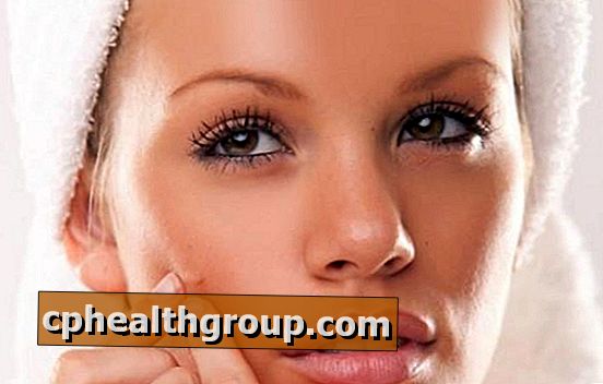 Hoe huidonzuiverheden door acne worden voorkomen