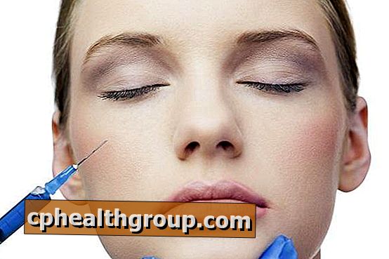 Как работи Botox върху лицето - ние ви казваме