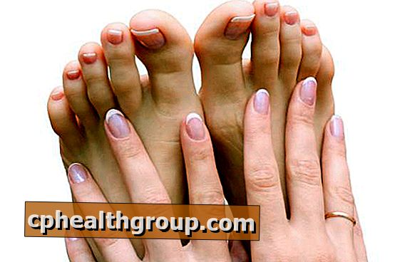 Hem rättsmedel för de gula naglarna på fötterna