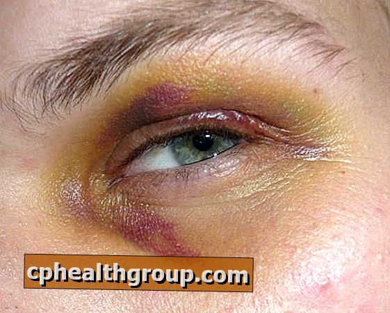 Як замаскувати пурпурне око
