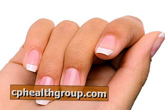 Come trattare le unghie striate