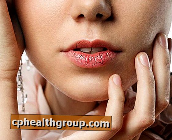 Hogyan távolítsuk el az ajkak száraz bőrét