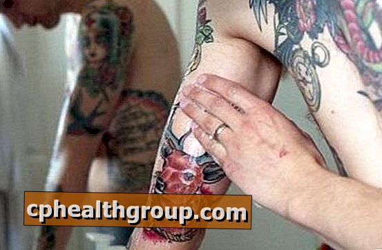 Ako vyliečiť tetovanie