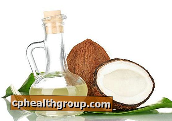 Kaip naudoti kokoso aliejų pleiskanai