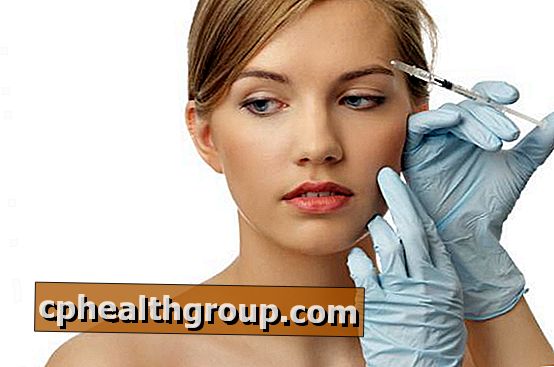 Hva er botox-bivirkningene?