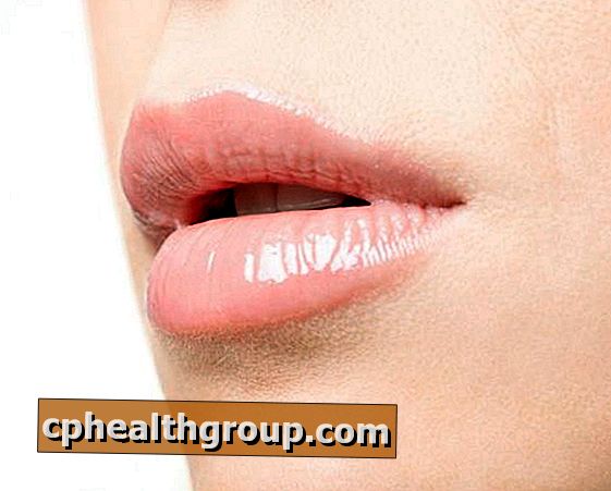 Hur man förhindrar sprickade läppar