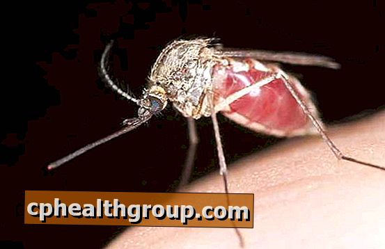 Aké sú príznaky malárie