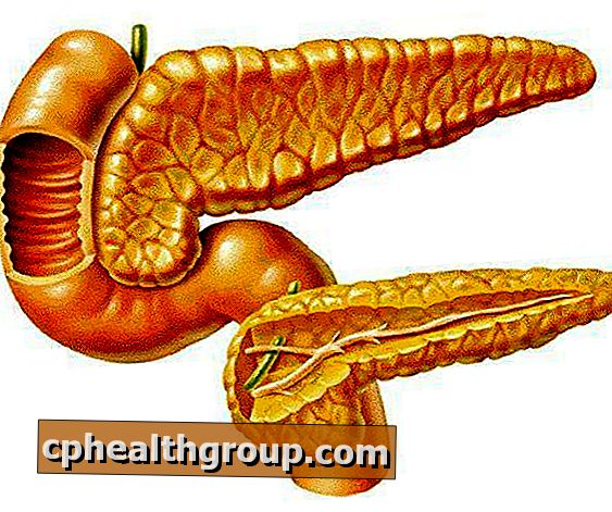 Come trattare l'infiammazione del pancreas