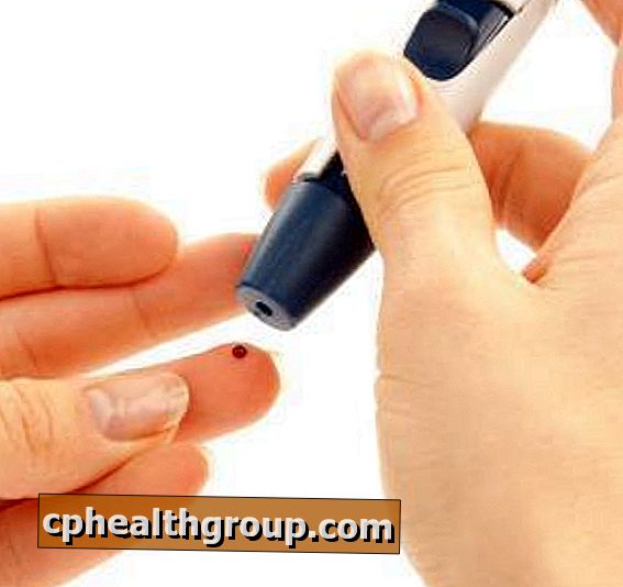 Kaip pasireiškia nuo insulino nepriklausomas cukrinis diabetas