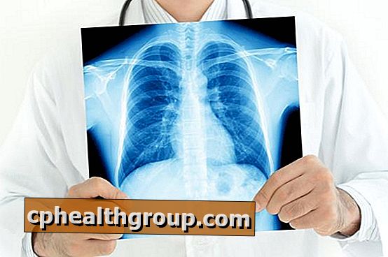 Príčiny škvŕn v pľúcach