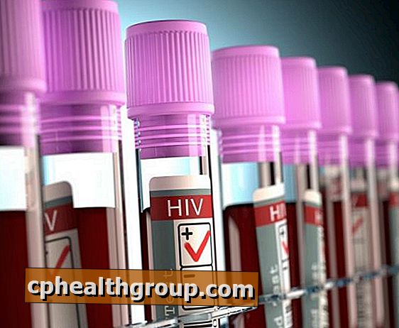Jak żyć z osobą z HIV