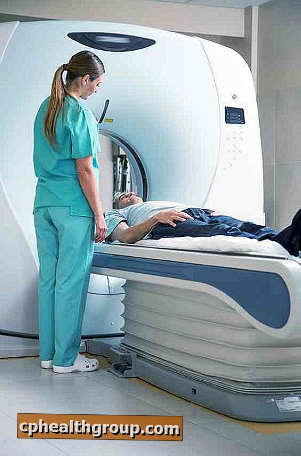Quali sono gli effetti collaterali della radioterapia