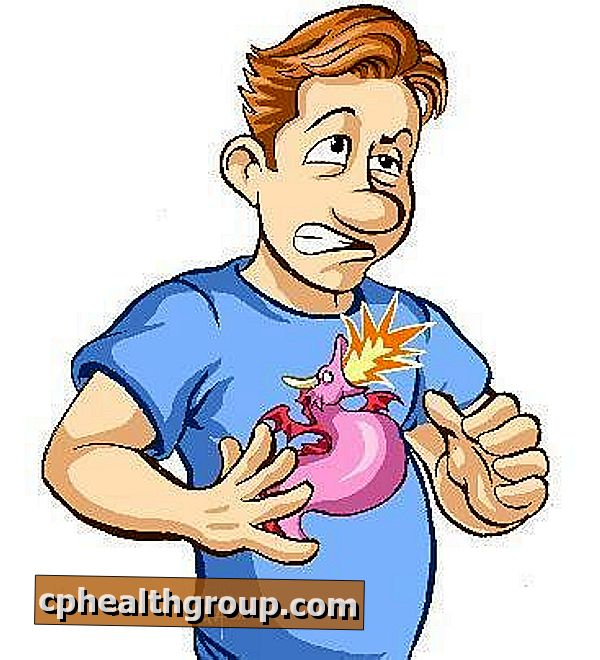 Kako se kaže gastroezofagealni refluks