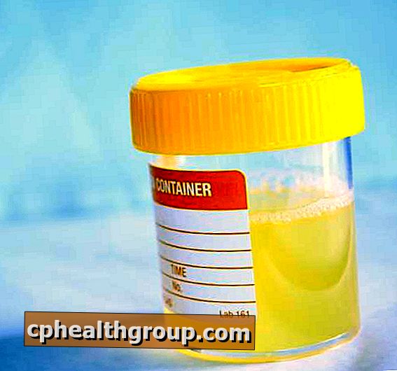Hur bota urininfektion med naturliga medel