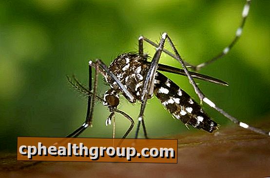 Millised on Zika viiruse sümptomid?