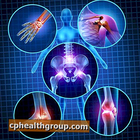 Kādi ir osteoporozes simptomi