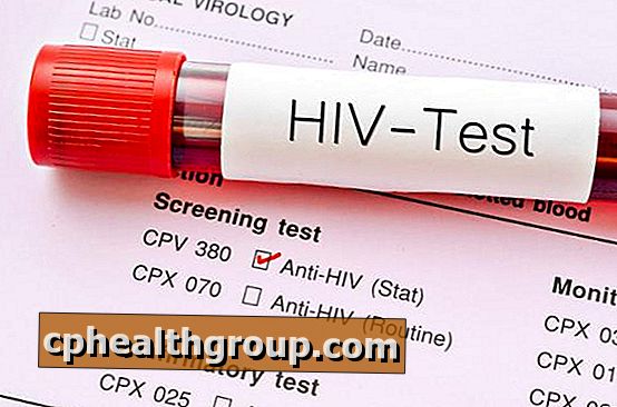 Hvordan vite om jeg har HIV uten å gå til legen