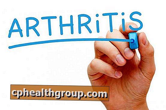 forume liječnika artritis liječenje)