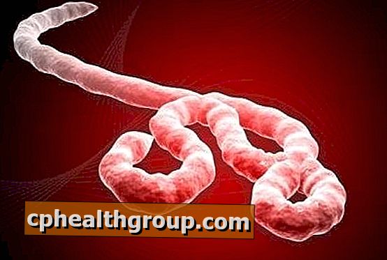 Quels sont les symptômes du virus Ebola?