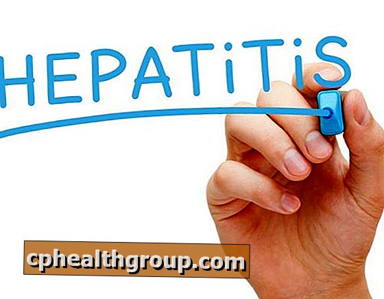 Какви са симптомите на хепатит А