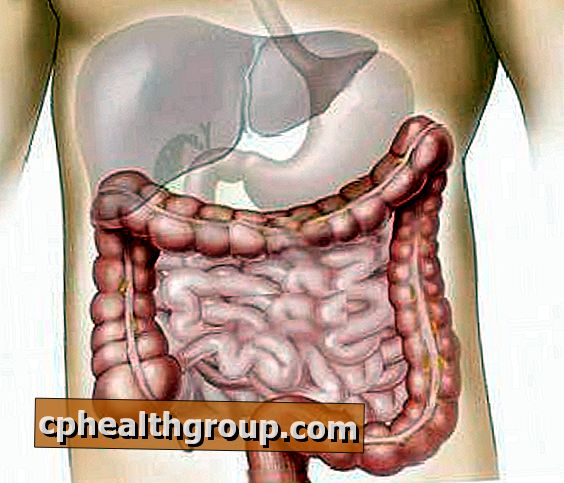 Hur man behandlar intestinal prolaps eller tarmförlust