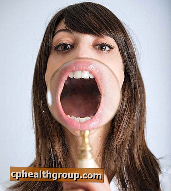 Jaké jsou příčiny ústní kandidózy?