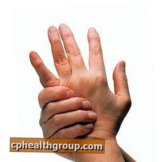 Quelles sont les maladies arthritiques?