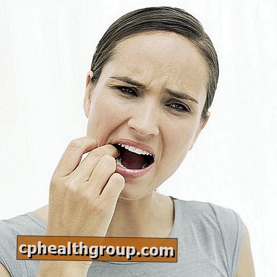 Wie kann man orale Candidiasis heilen?
