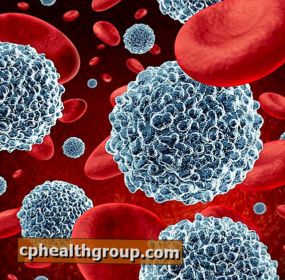 Jaké jsou příčiny nárůstu bílých krvinek?