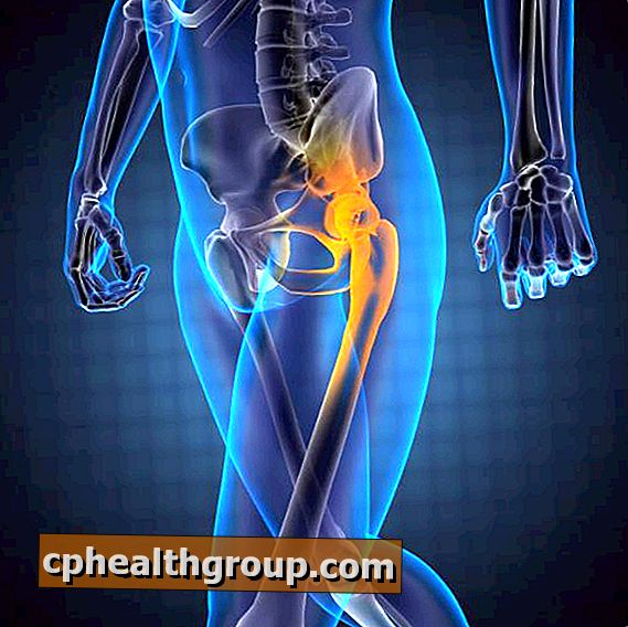 Korektivne osteotomije u području koljena