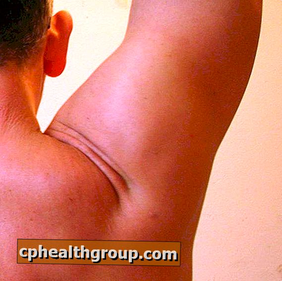 Exercices pour l'arthrite de l'épaule