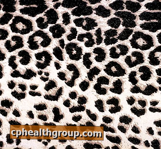 Wie man Leopardgamaschen trägt