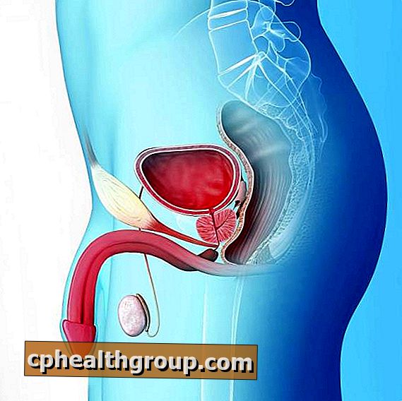 Prostata inflamată sau prostatita – Top 3 remedii naturale