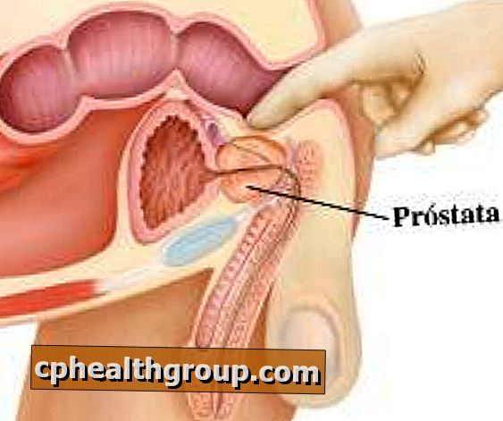 pregled prostate