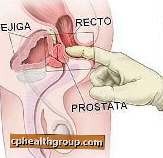 pregled prostate)