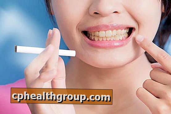 Wie entferne ich gelbe Flecken von den Zähnen durch Rauchen?