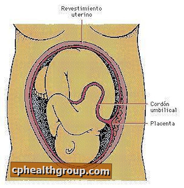 Hur den tidigare förlossningen av placentan behandlas