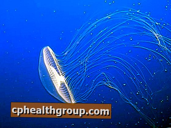 Jak leczyć użądlenia jellyfish