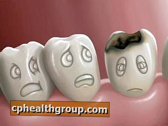 “Szörnyen fáj a fogam. Bárcsak tudnám miért!?” | Déli Dental fogorvos Budapest