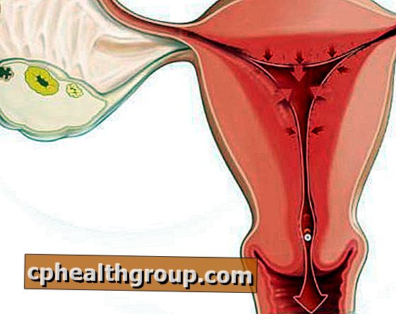Cum se manifestă retroversiunea uterului gravid