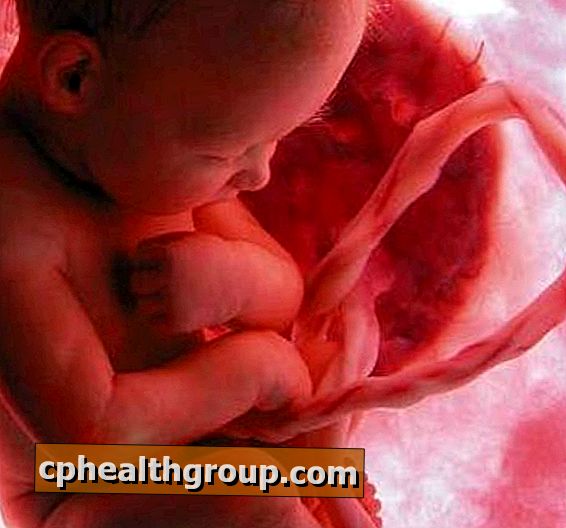 Como o descolamento prematuro da placenta se manifesta