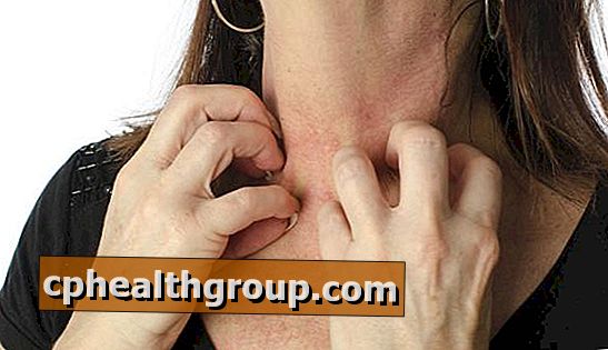 Simptomai ir erkių alergijos gydymas