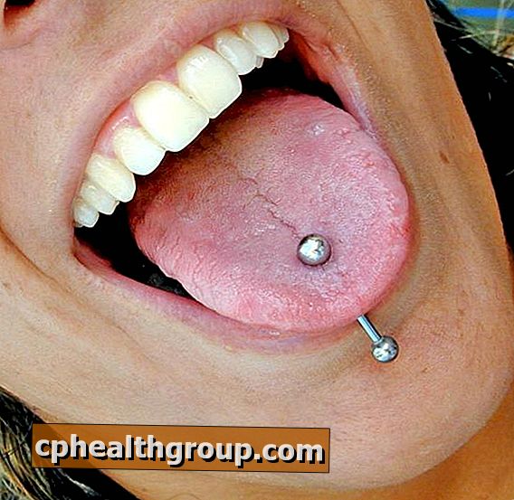 Wie kann man Entzündungen durch ein Zungenpiercing reduzieren?